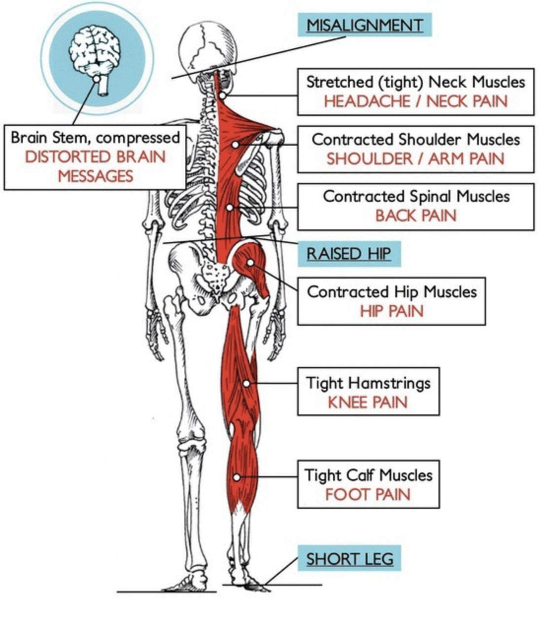 Chiropractic Benefits